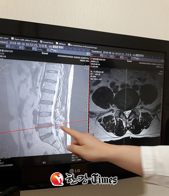김경수 경남도지사 뒷덜미를 잡았던 사회운동가 천창룡씨의 치료를 맡고 있는 담당 의사가 천창룡씨의 허리를 촬영한 MRI 필름을 설명하고 있다. 사진 : 천창룡씨 제공