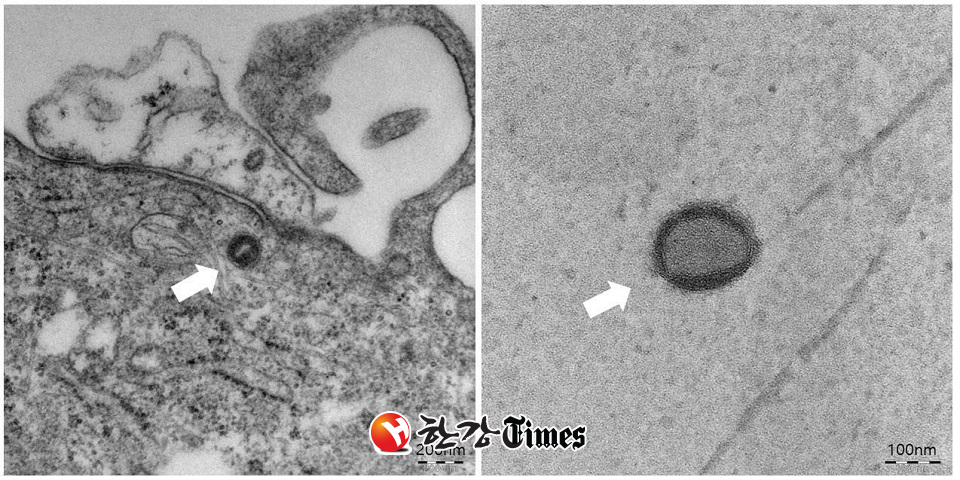 질병관리청이 분리배양에 성공한 원숭이두창 바이러스. (사진=질병관리청 제공)