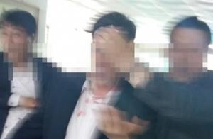 ‘난장판 된 사드배치 설명회’ 조희현 경북경찰청장, 물병에 맞아 부상