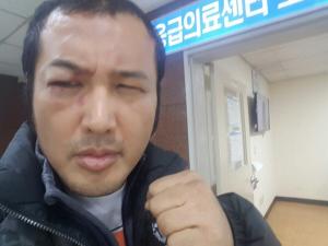 [로드 FC 데뷔전] 김보성, 눈뼈 골절…"수술 위기"